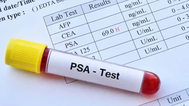 最新の2025年前立腺特異抗原（PSA）検査市場調査では、画期的なトレンドと機会が明らかにされています。競合他社に先駆けて、リアルタイムの業界データ、価格分析、専門家の予測を入手しましょう。