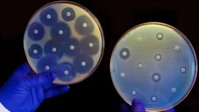 最新の2025年抗菌薬感受性試験市場調査では、画期的なトレンドと機会が明らかにされています。競合他社に先駆けて、リアルタイムの業界データ、価格分析、専門家の予測を入手しましょう。